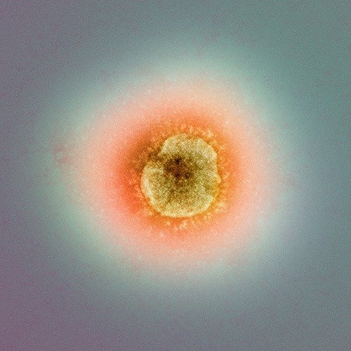 新型コロナウイルスの顕微鏡写真。1つは100nm（1万分の1mm）程度だ。...